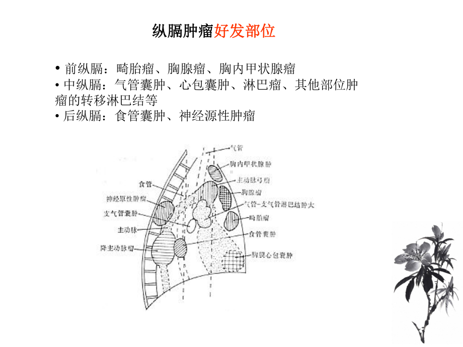 纵隔囊性病变小讲座课件.ppt_第3页