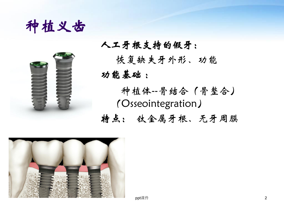 《口腔修复学》种植义齿-ppt课件.ppt_第2页