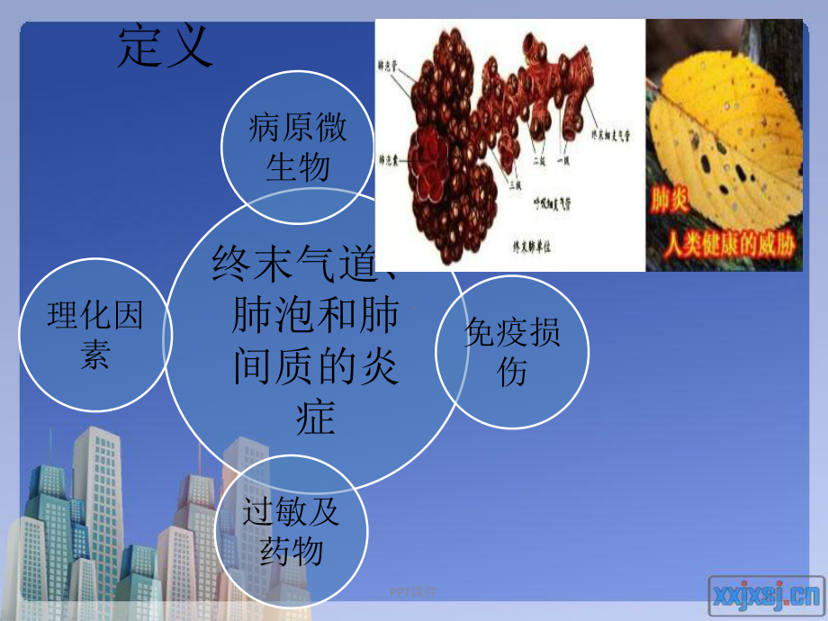 肺炎护理查房（呼吸内科）-ppt课件.ppt_第2页