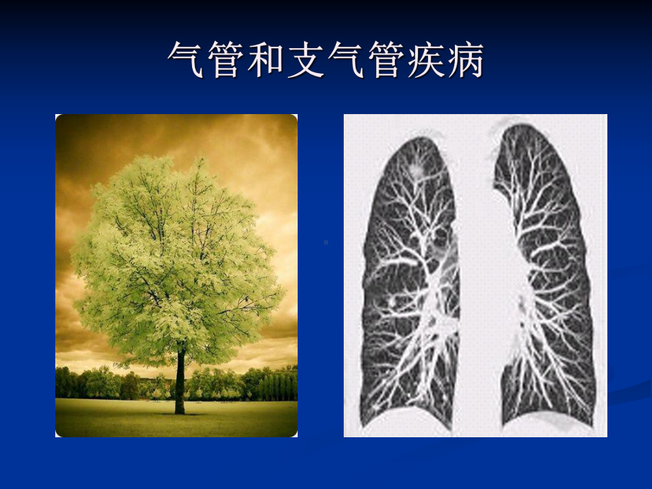 医学影像诊断学-呼吸系统3课件.ppt_第2页