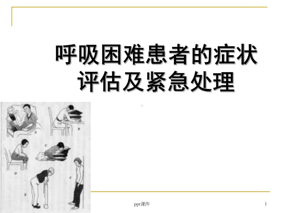 呼吸困难患者的紧急护理-ppt课件.ppt_第1页