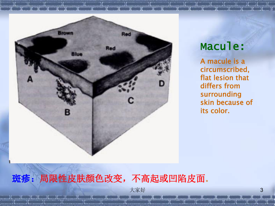 皮肤科基础皮损描述-PPT课件.ppt_第3页