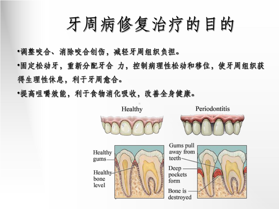 牙周病怎么办图片