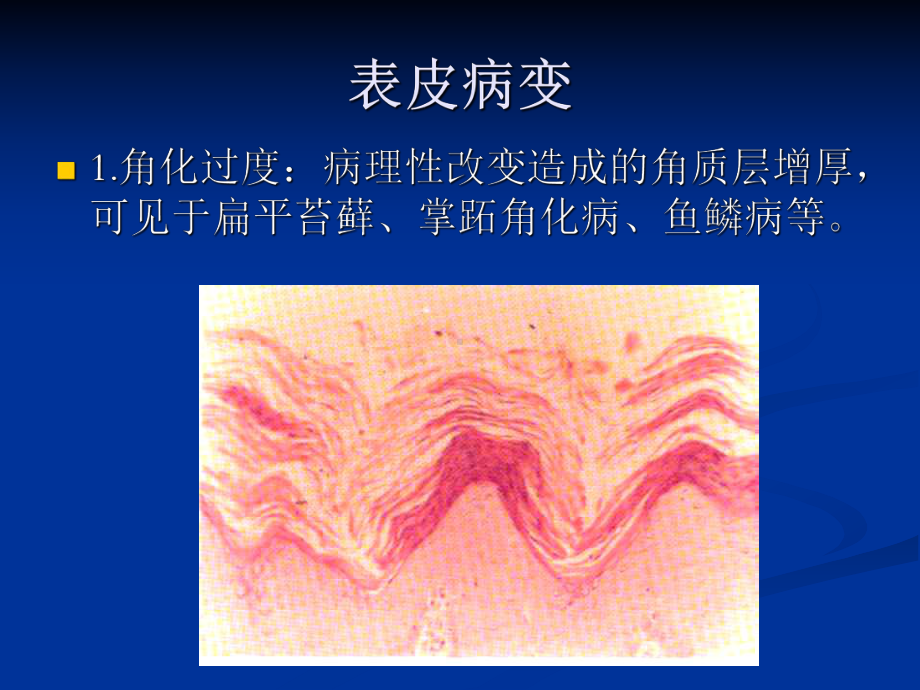 皮肤组织病理学课件.ppt_第3页