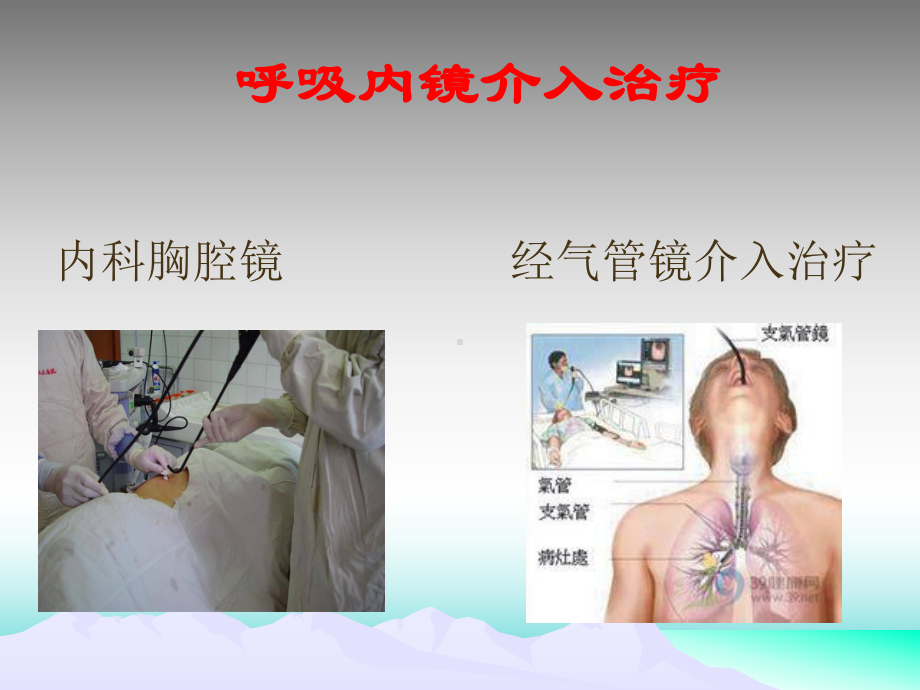 呼吸内镜介入治疗新进展课件.ppt_第2页