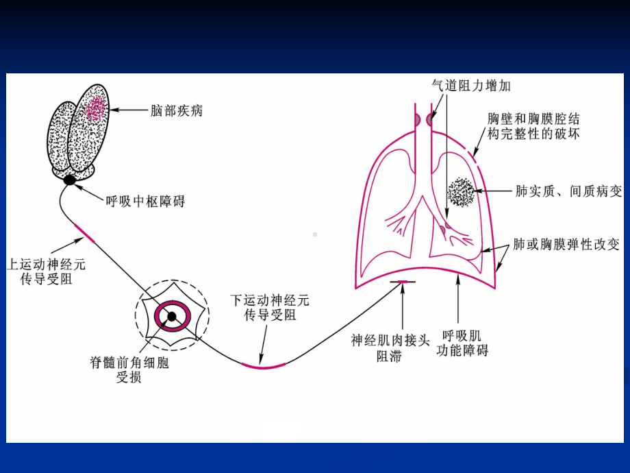 第十三章-呼吸衰竭赵明-护理学课件.ppt_第3页