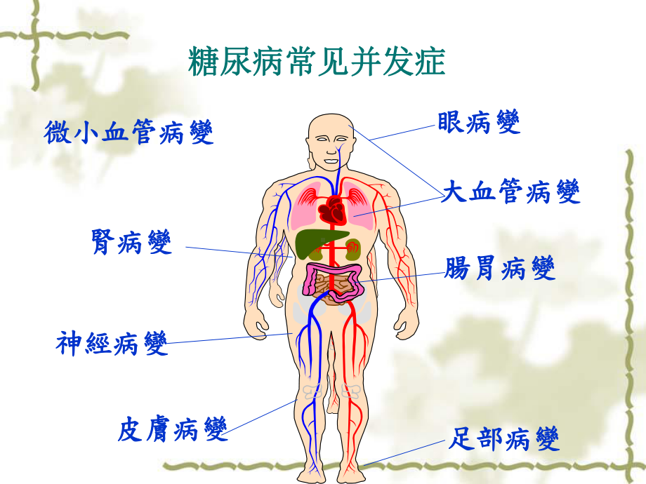 糖尿病周围神经病变-PPT课件 同名 ).ppt_第2页