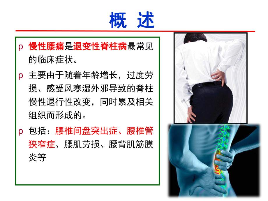 腰腿痛的中医康复治疗-ppt课件.ppt_第2页