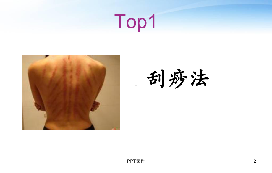 中医特色疗法（传统医学科）-ppt课件.ppt_第2页