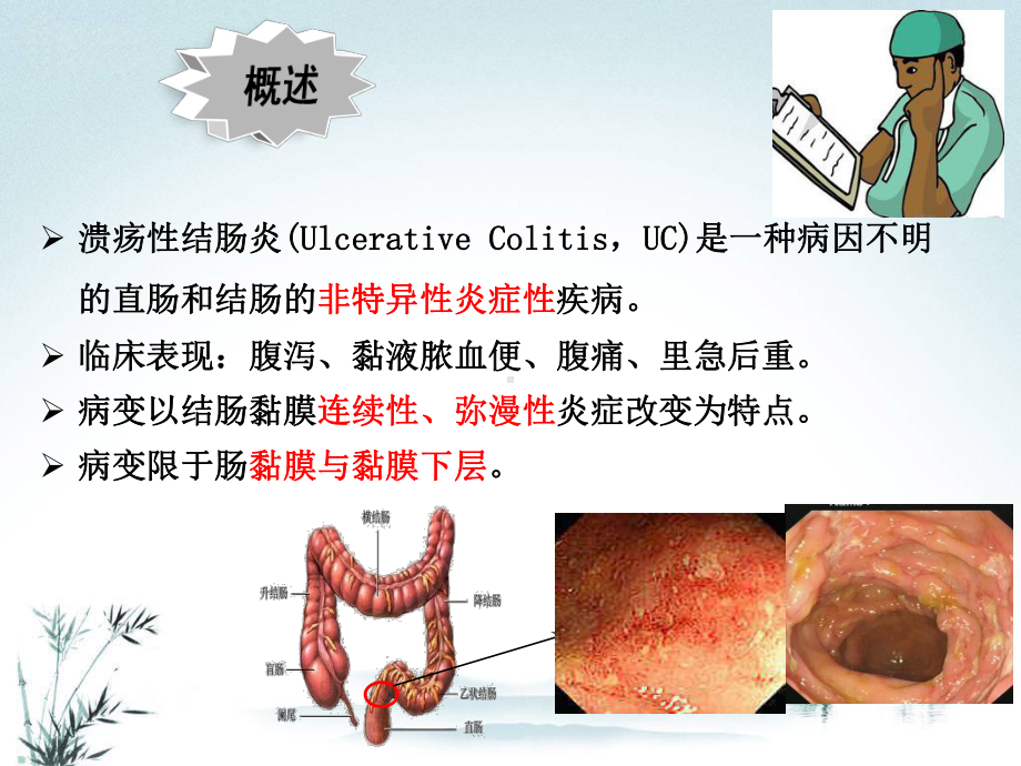 中医治疗溃疡性结肠炎的难点及优势课件.pptx_第2页