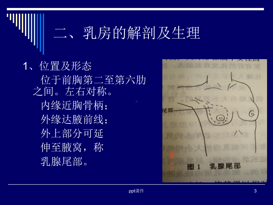 中医外科学-乳房疾病概述-ppt课件.ppt_第3页