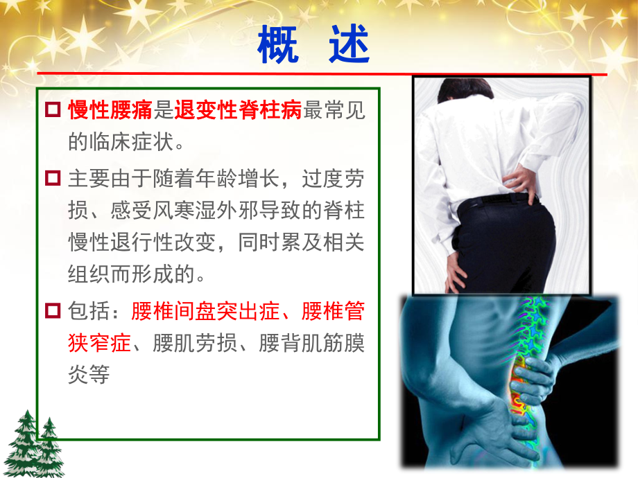 慢性腰痛的中医康复治疗策略-ppt课件.ppt_第2页