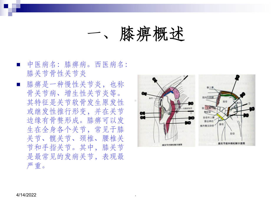 膝关节炎中医护理课件.ppt_第3页