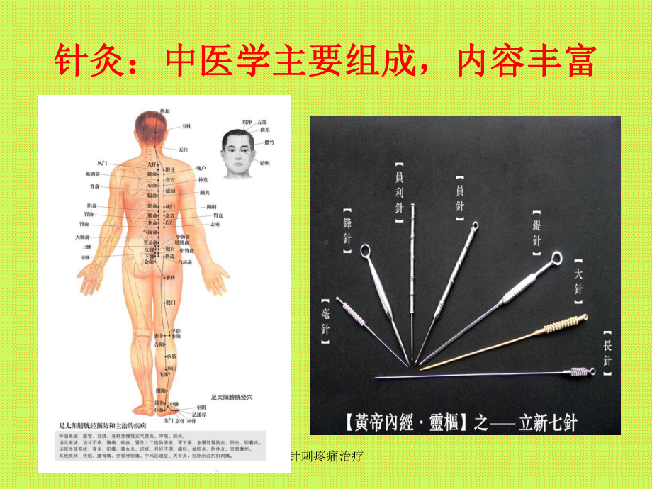 针刺疼痛治疗-ppt课件.ppt_第2页