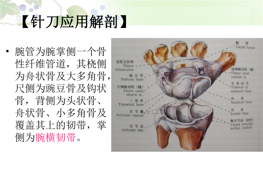 针刀治疗腕管综合征PPT培训课件.ppt_第3页