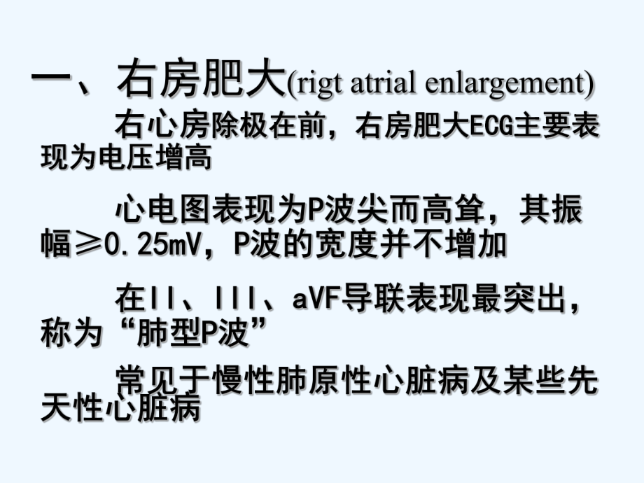 诊断学异常心电图[可修改版ppt]课件.ppt_第2页