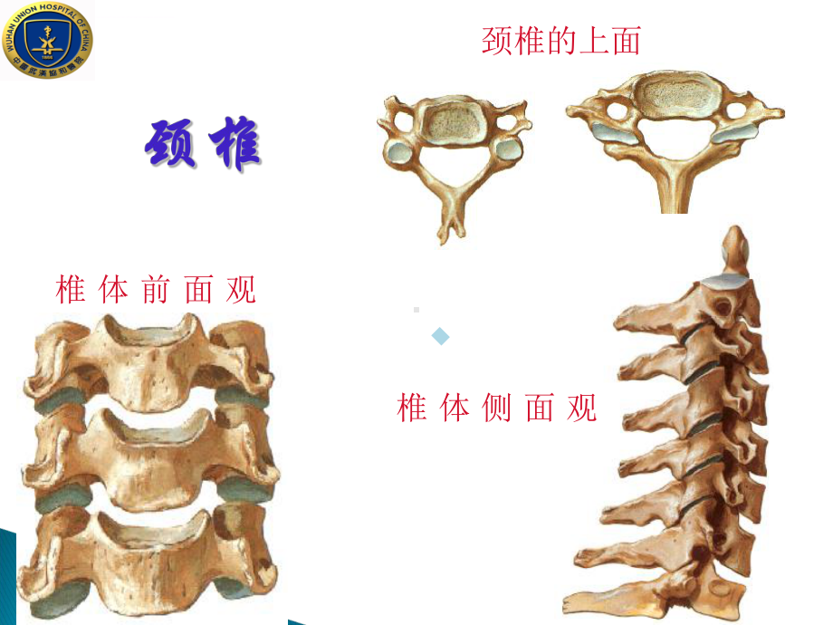 颈椎病的预防与保健-3ppt课件.ppt_第3页