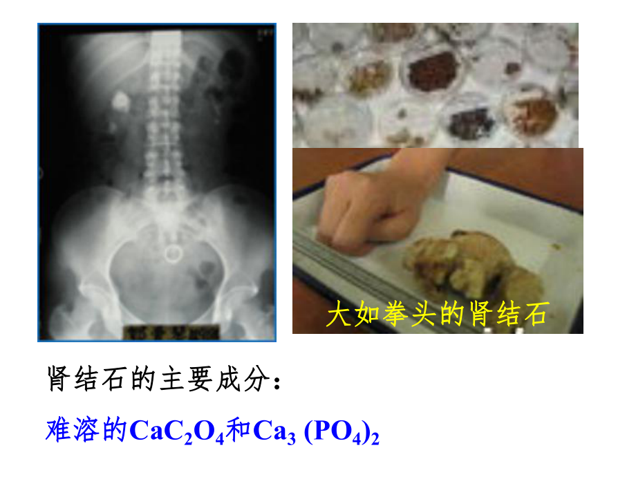 沉淀溶解平衡教学设计课件.pptx_第1页