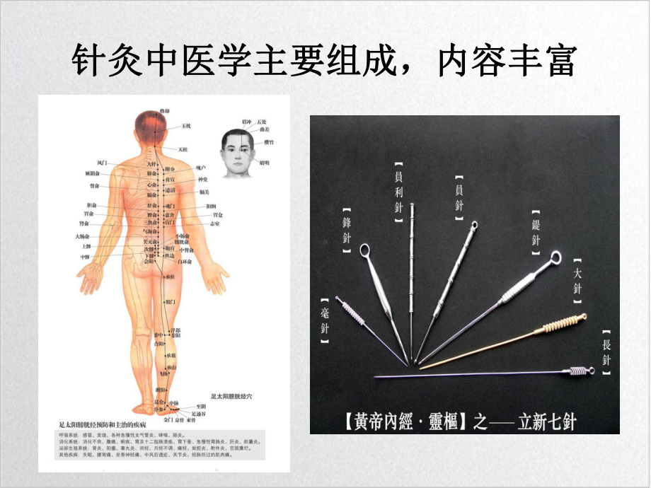 针刺疼痛治疗PPT培训课件.ppt_第2页