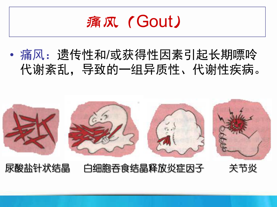 高尿酸血症痛风和肾脏病PPT课件.ppt_第3页