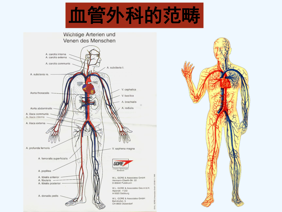 血管外科疾病版(ppt)课件.ppt_第3页