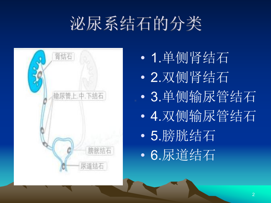 泌尿系结石的治疗PPT参考幻灯片课件.ppt_第2页