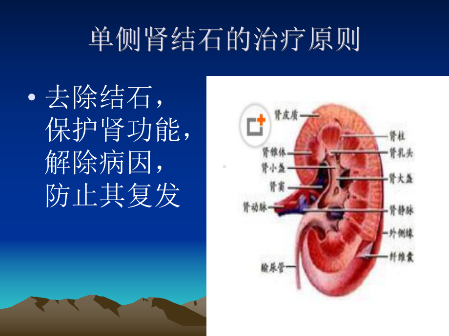 泌尿系结石的治疗PPT参考幻灯片课件.ppt_第3页