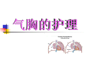 气胸的分类及护理培训ppt课件.pptx