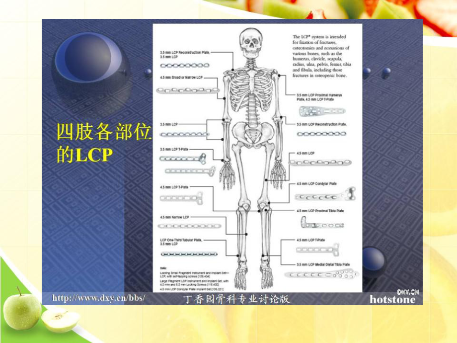 锁定钢板应用原则及术中细节优选演示课件.ppt_第3页