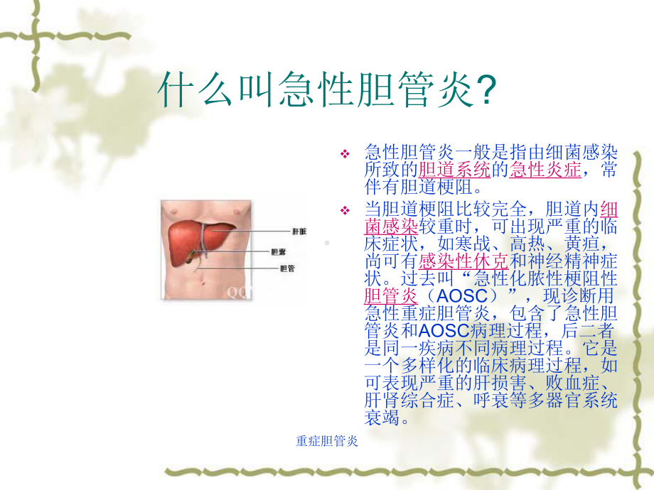 重症胆管炎-ppt课件.ppt_第3页