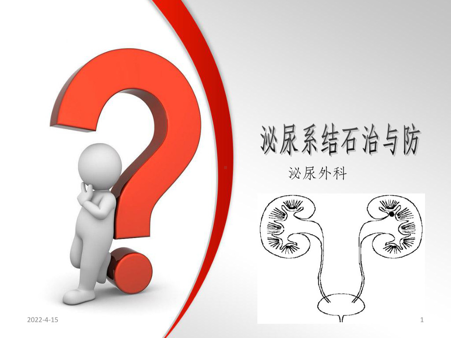 泌尿系结石健康教育PPT课件.ppt_第1页