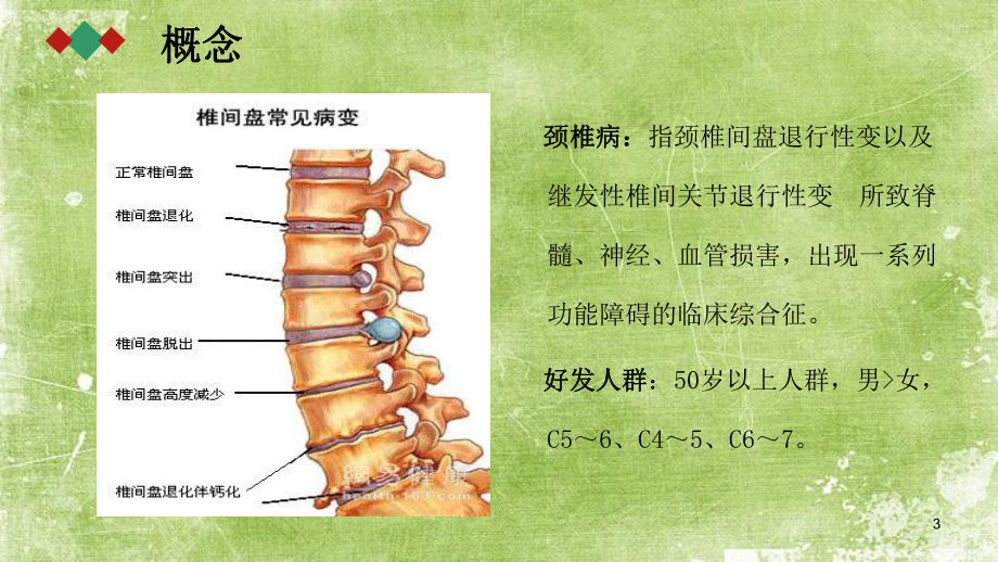 颈椎病的护理查房-PPT课件.pptx_第3页