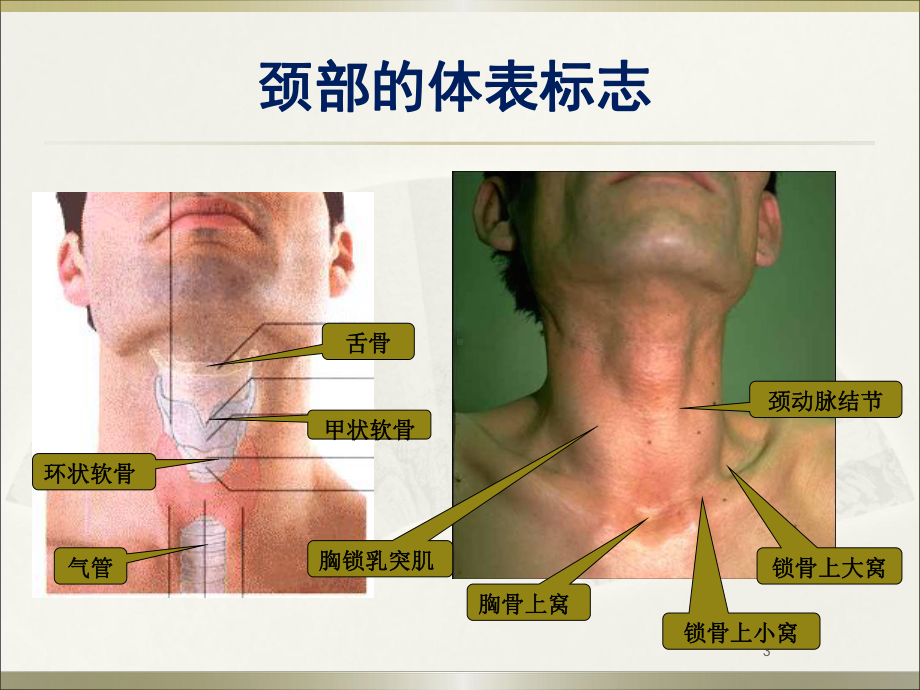 气管切开术精品PPT课件.pptx_第3页