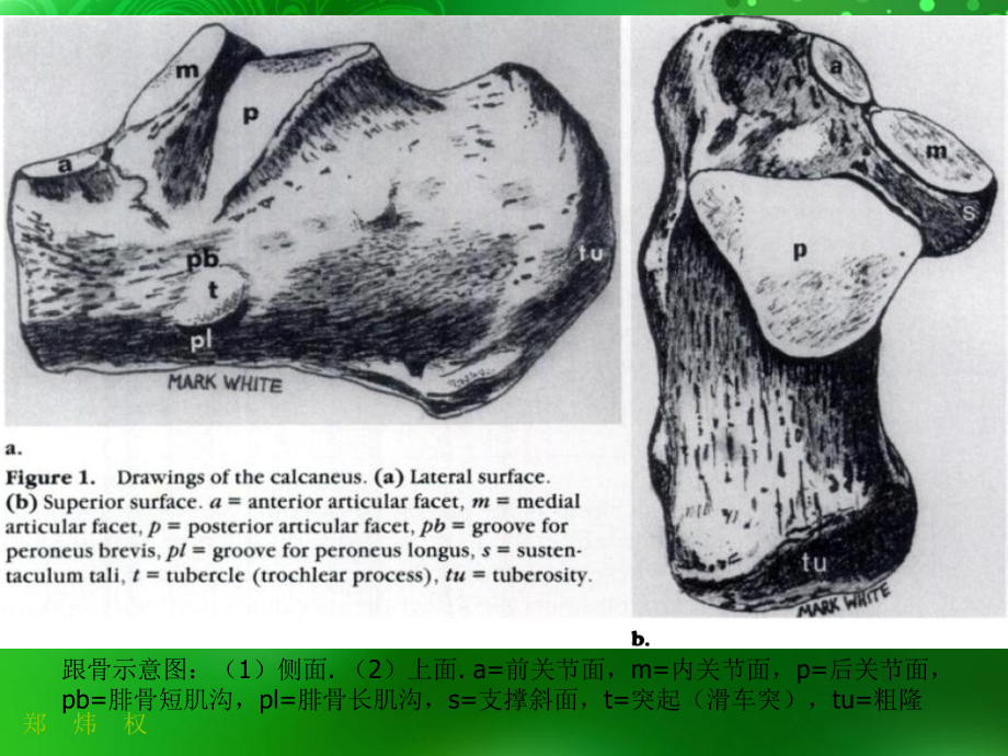 跟骨正常与变异-医学课件.ppt_第3页