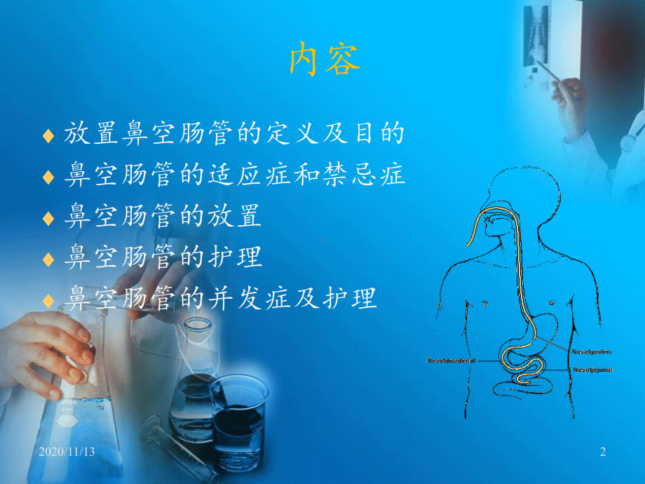 鼻肠管的护理-ppt课件.ppt_第2页