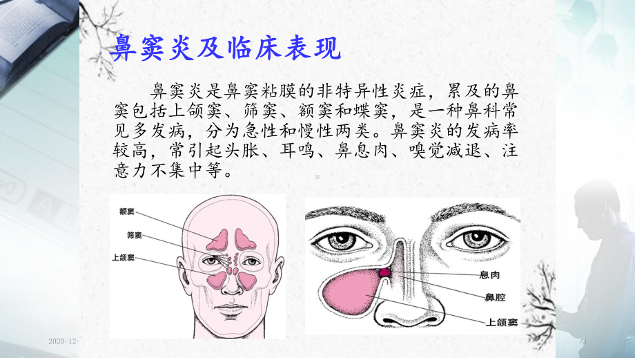 鼻窦炎护理(PPT课件).ppt_第3页