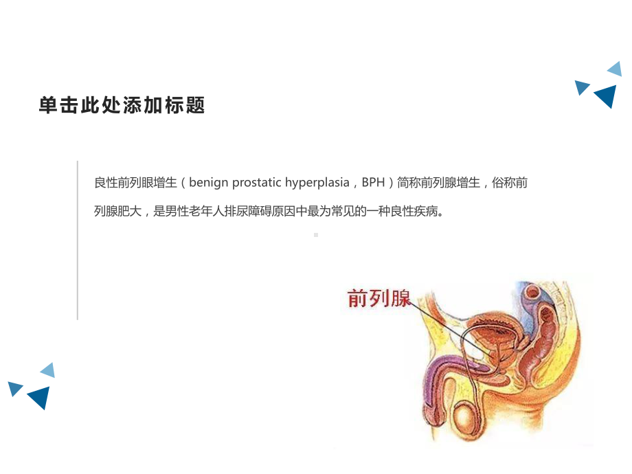 泌尿外科良性前列腺增生护理查房PPT课件.ppt_第3页