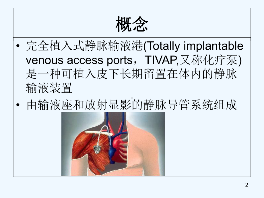 植入式静脉输液港的护理-PPT课件.ppt_第2页