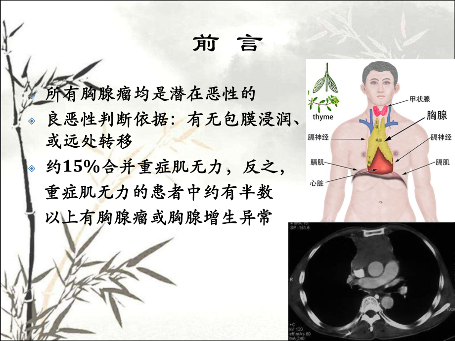 胸腺瘤的分期治疗ppt课件.ppt_第3页