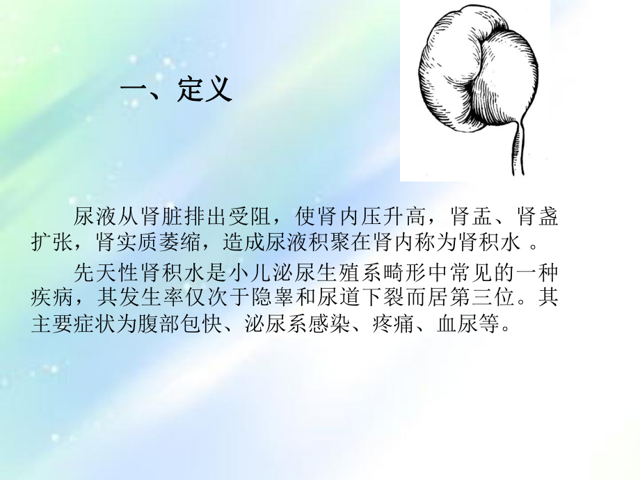 肾积水的护理ppt课件.ppt_第2页