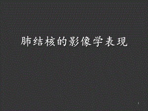 肺结核影像学表现课件.ppt