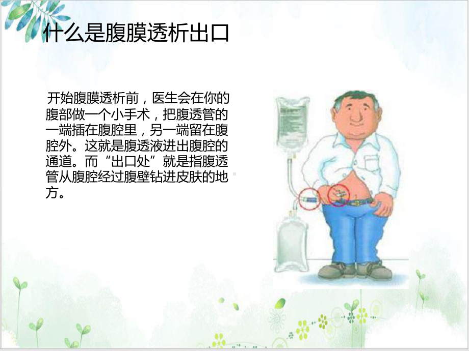 腹膜透析出口护理课件PPT.ppt_第2页