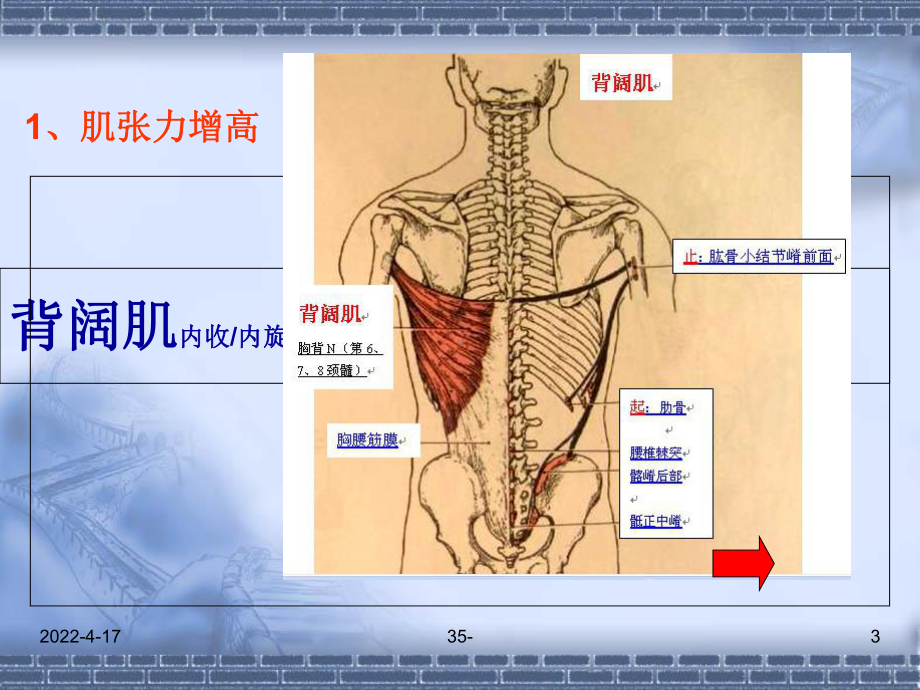 痉挛型脑瘫康复PPT课件.ppt_第3页