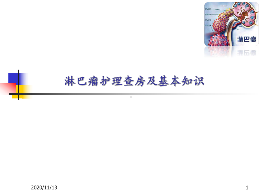 淋巴瘤护理查房-ppt课件.ppt_第1页