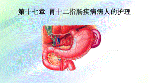 胃十二指肠疾病病人的护理-PPT课件.ppt