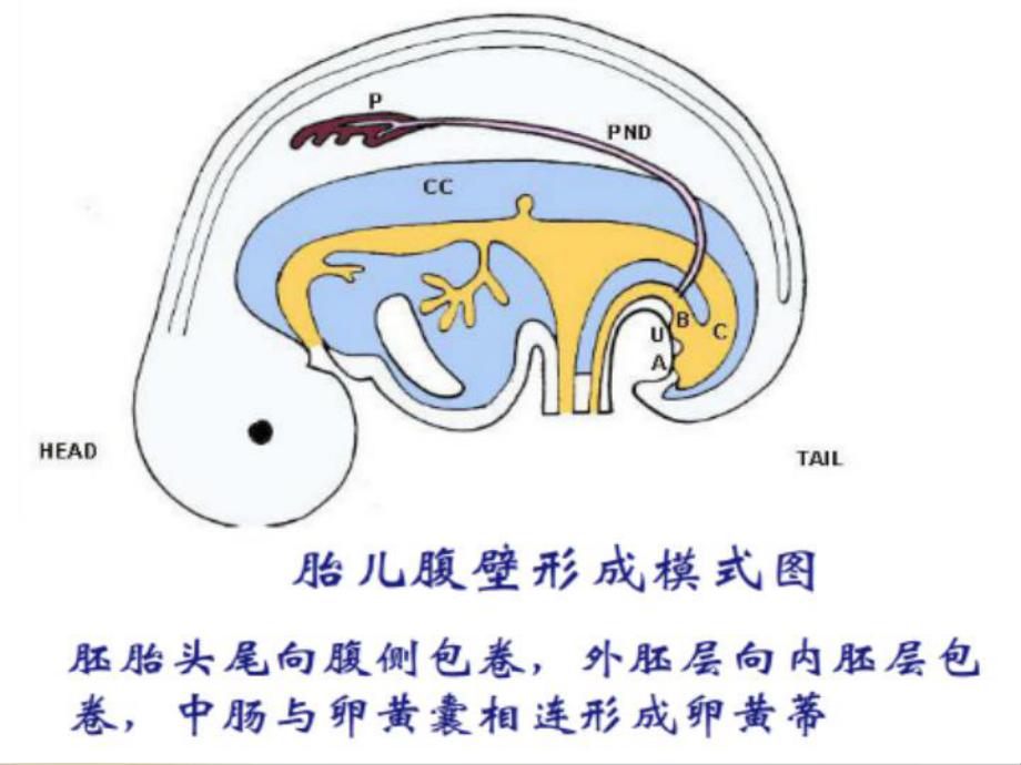 胎儿前腹壁畸形超声诊断PPT培训课程课件.ppt_第3页