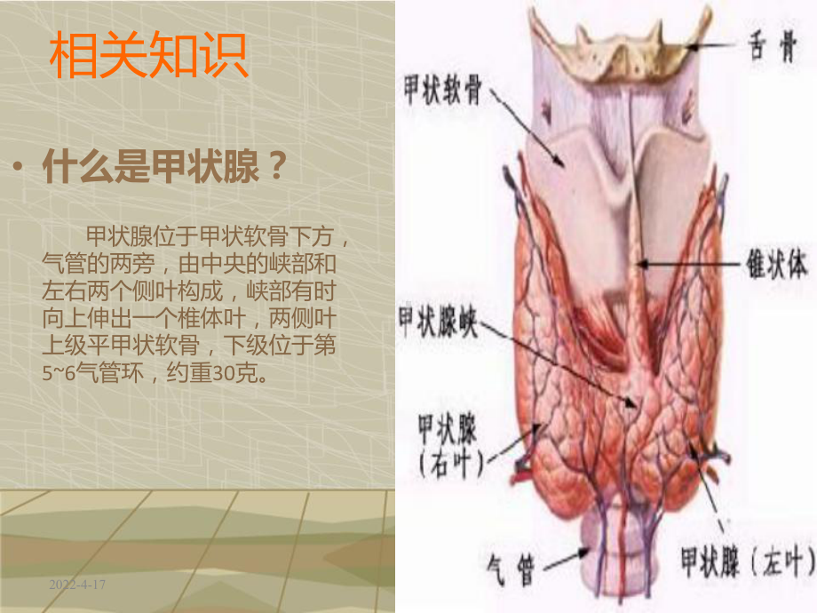 甲状腺肿护理查房1课件.pptx_第3页