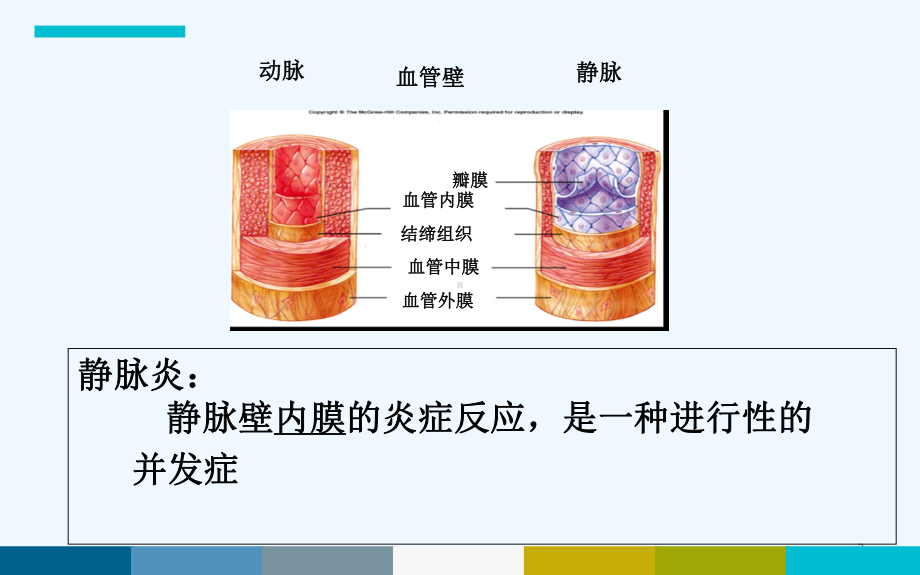 胺碘酮致静脉炎-PPT课件.ppt_第2页