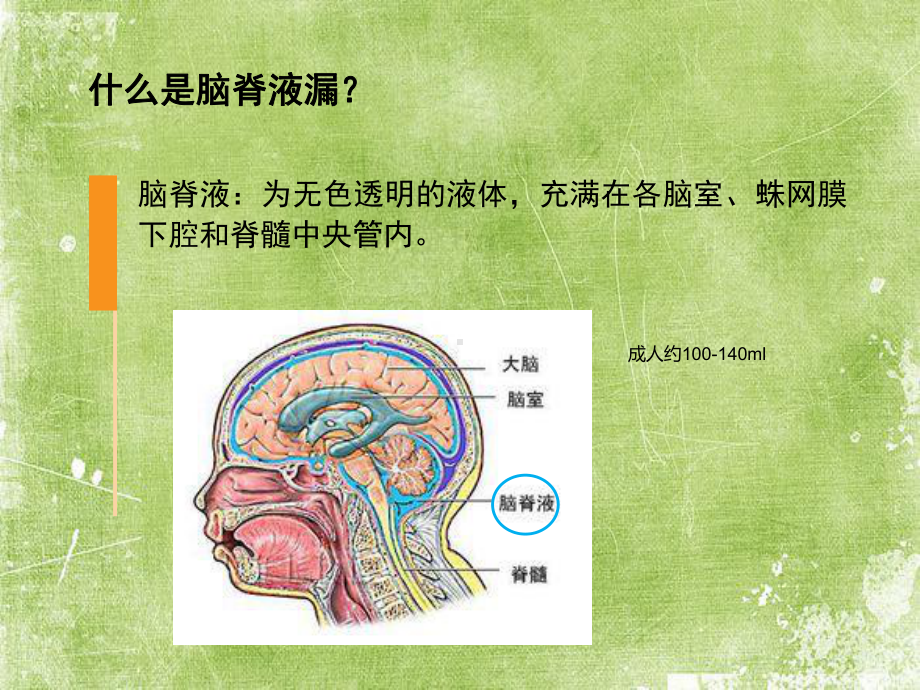 脑脊液漏的护理ppt课件.ppt_第3页