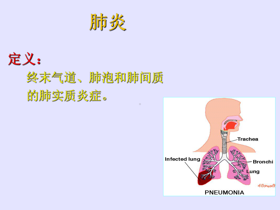 肺炎汇总ppt培训课件.ppt_第3页